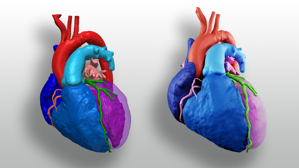 heart 3d scan